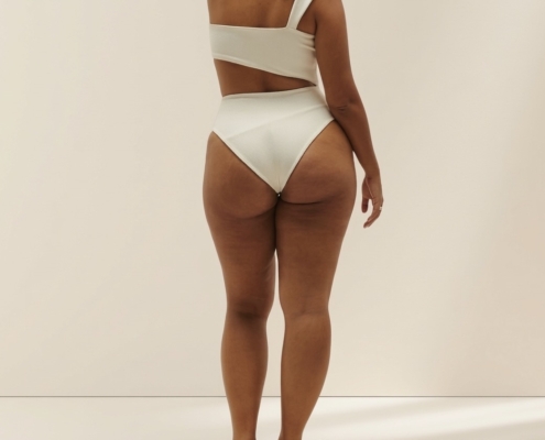 Lipedema vs Lymphedema Manual Lymphatic Drainage in Wayne NJ