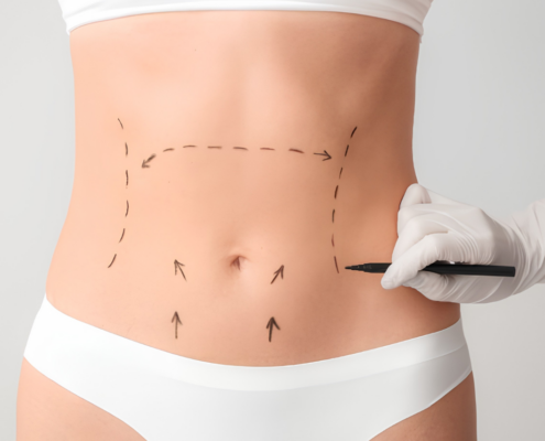 Post-op manual lymphatic drainage for surgical recovery total body wayne NJ