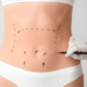 Post-op manual lymphatic drainage for surgical recovery total body wayne NJ