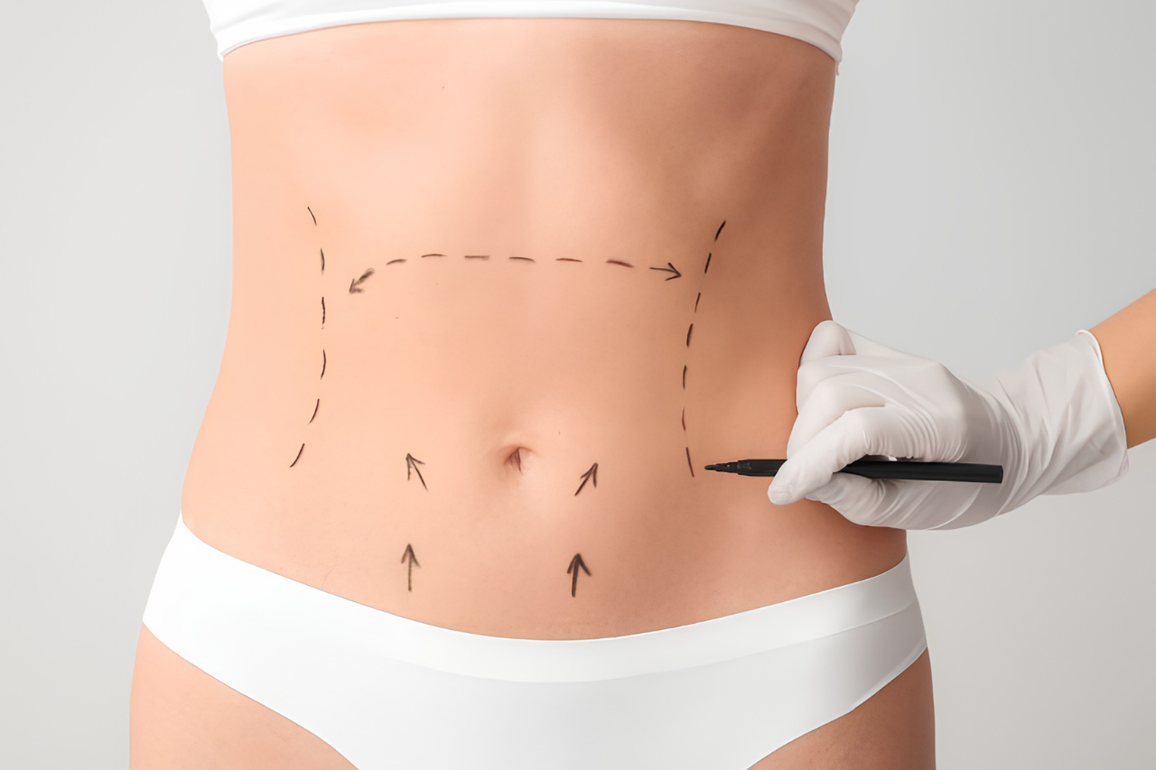 Post-op manual lymphatic drainage for surgical recovery total body wayne NJ